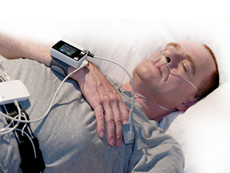 Treatment by acupuncture